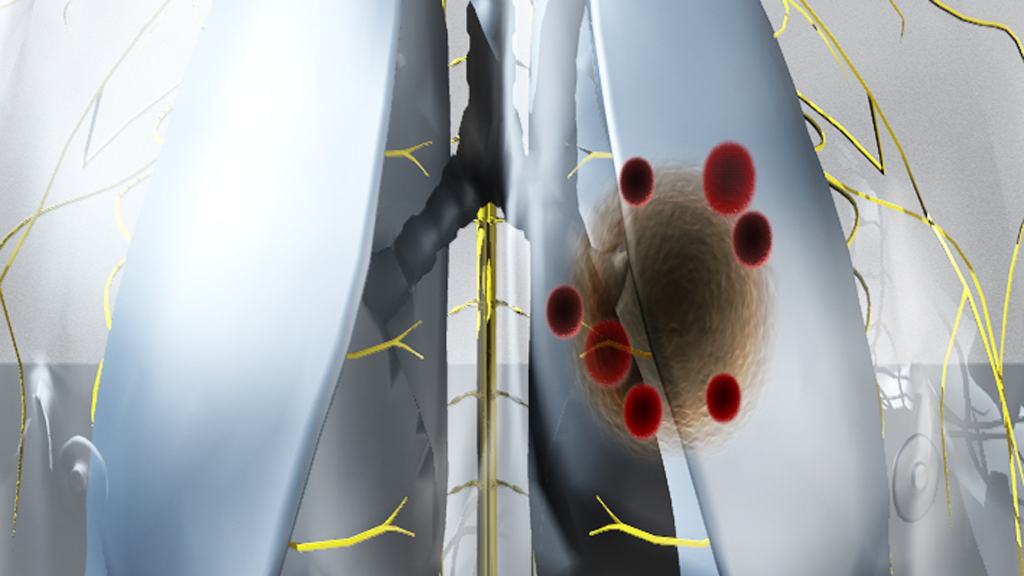 Breakthrough cancer blood test to be made available in UK – Channel 4 News